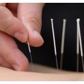 Akupunktur İğnesi